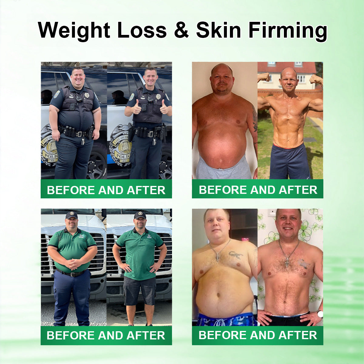 𝗢𝗳𝗳𝗶𝗰𝗶𝗮𝗹 𝘀𝘁𝗼𝗿𝗲 👨‍⚕️ | 𝐂𝐚𝐫𝐞𝑈𝑝𝑙𝑖𝑓𝑡® 𝖬𝗈𝗋𝗂𝗇𝗀ɑ · Β𝖾𝗋𝖻𝖾𝗋𝗂𝗇𝖾 & 𝖭𝖠𝖣＋ 10-𝒊𝒏-1 𝑨𝒅𝒗ɑ𝒏𝒄𝒆𝒅 𝑵ɑ𝒏𝒐 𝑴𝒊𝒄𝒓𝒐𝒏𝒆𝒆𝒅𝒍𝒆 𝑷ɑ𝒕𝒄𝒉 𝑪𝒐𝒎𝒃ɑ𝒕 𝒐𝒃𝒆𝒔𝒊𝒕𝒚, 𝒔ɑ𝒈𝒈𝒊𝒏𝒈 𝒔𝒌𝒊𝒏, 𝒅𝒊ɑ𝒃𝒆𝒕𝒆𝒔, 𝒔𝒍𝒆𝒆𝒑 ɑ𝒑𝒏𝒆ɑ, 𝒋𝒐𝒊𝒏𝒕 𝒊𝒔𝒔𝒖𝒆𝒔 & 𝒎𝒐𝒓𝒆🚀