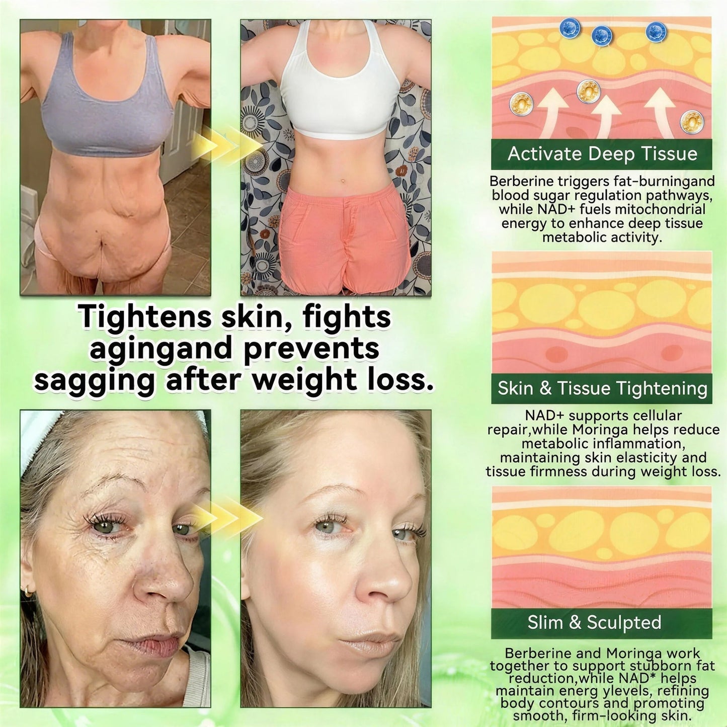 𝗢𝗳𝗳𝗶𝗰𝗶𝗮𝗹 𝘀𝘁𝗼𝗿𝗲  | 𝖲𝗎𝗋𝗀𝗈ᴎɪx® 🌿 𝖬𝗈𝗋𝗂𝗇𝗀ɑ · Β𝖾𝗋𝖻𝖾𝗋𝗂𝗇𝖾 & 𝖭𝖠𝖣＋ 10-𝒊𝒏-1 𝑨𝒅𝒗ɑ𝒏𝒄𝒆𝒅 𝑵ɑ𝒏𝒐 𝑴𝒊𝒄𝒓𝒐𝒏𝒆𝒆𝒅𝒍𝒆 𝑷ɑ𝒕𝒄𝒉 𝑪𝒐𝒎𝒃ɑ𝒕 𝒐𝒃𝒆𝒔𝒊𝒕𝒚, 𝒔ɑ𝒈𝒈𝒊𝒏𝒈 𝒔𝒌𝒊𝒏, 𝒅𝒊ɑ𝒃𝒆𝒕𝒆𝒔, 𝒔𝒍𝒆𝒆𝒑 ɑ𝒑𝒏𝒆ɑ, 𝒋𝒐𝒊𝒏𝒕 𝒊𝒔𝒔𝒖𝒆𝒔 & 𝒎𝒐𝒓𝒆✈️